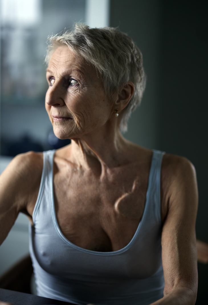 Kvinne (60) med uhelbredelig brystkreft